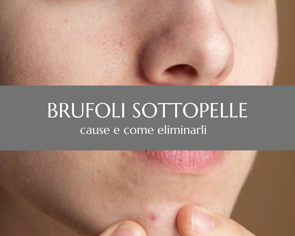 Brufoli sottopelle