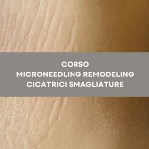 Corso Microneedling Remodeling Cicatrici Smagliature